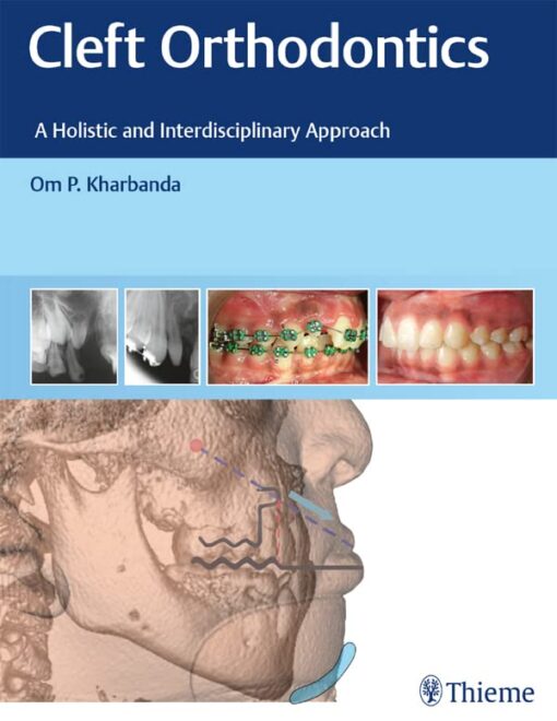 Cleft Orthodontics: A Holistic and Interdisciplinary Approach 1st Edition PDF Original 