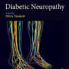 Diabetic Neuropathy