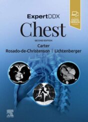 ExpertDDx: Chest, 2nd Edition