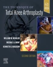 In 1990, Dr. Kenneth Krackow wrote The Technique of Total Knee Arthroplasty to teach the basics of TKA for end-stage arthritis—everything from nonsurgical to surgical intervention and postoperative rehabilitation.