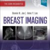 Breast Imaging