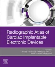 radiographic-atlas-of-cardiac-implantable-electronic-devices