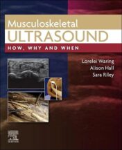 Musculoskeletal Ultrasound: How, Why and When 1st Ed