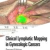 Clinical Lymphatic Mapping in Gynecologic Cancers, 2nd Edition