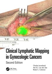 Clinical Lymphatic Mapping in Gynecologic Cancers, 2nd Edition