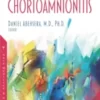 Chorioamnionitis