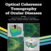 Optical Coherence Tomography of Ocular Diseases