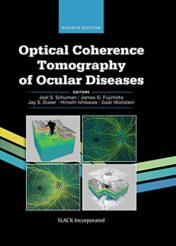 Optical Coherence Tomography of Ocular Diseases