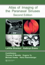 Atlas of Imaging of the Paranasal Sinuses, Second Edition