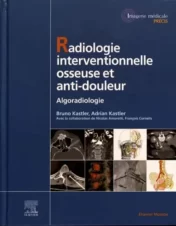 Radiologie Interventionnelle osseuse et anti-douleur: Algoradiologie (Original PDF