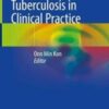 Tuberculosis in Clinical Practice