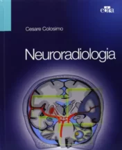 Il volume è rivolto ai radiologi generali e vuole rappresentare una guida per affrontare le patologie endocraniche e spinali. Nella trattazione degli argomenti è stata adottata la modalità “how-to, che fornisce le indicazioni pratiche per l’esecuzione, l’interpretazione e la refertazione delle indagini neuroradiologiche