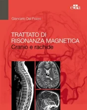 Trattato di Risonanza Magnetica: Cranio e rachide