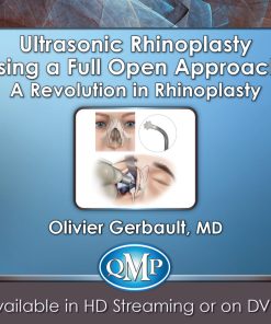 Ultrasonic Rhinoplasty Using a Full Open Approach: A Revolution in Rhinoplasty