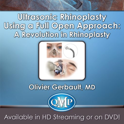 Ultrasonic Rhinoplasty Using a Full Open Approach: A Revolution in Rhinoplasty