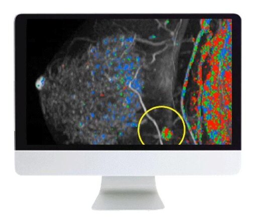 ARRS Breast Imaging Pearls and Pitfalls: Traditional and Novel Imaging Approaches 2020