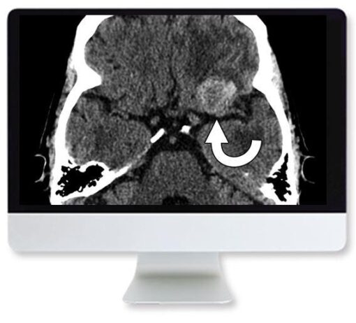 ARRS Clinical Case-Based Review of Neuroradiology 2019