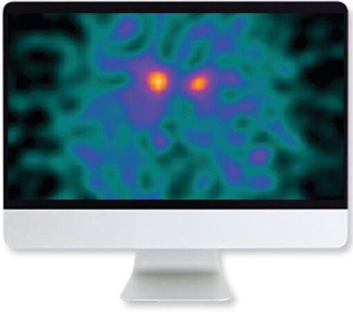 ARRS Clinical Case-Based Review of Nuclear Medicine 2019