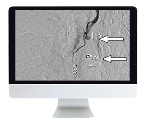 ARRS Clinical Case-Based Review of Vascular and Interventional Imaging 2019