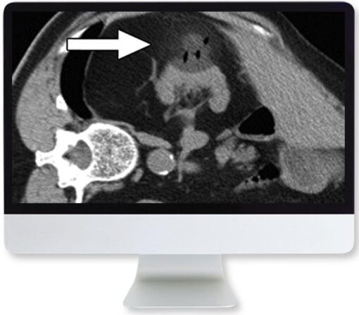 ARRS Cross-Sectional Renal Imaging: Techniques and Diagnosis 2020