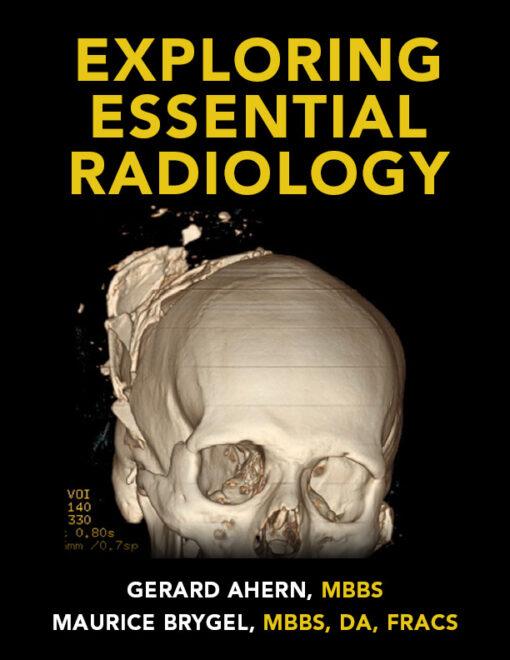 Exploring Essential Radiology (Videos)