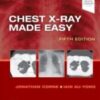 Chest X-Ray Made Easy, 5th edition 2022 True PDF