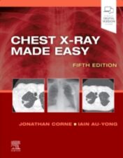 Chest X-Ray Made Easy, 5th edition 2022 True PDF