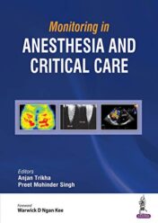 Monitoring in Anesthesia and Critical Care