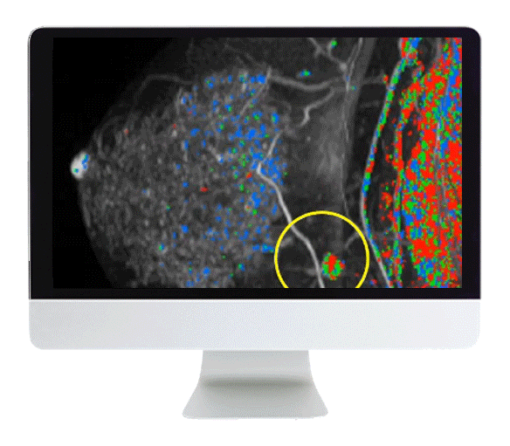 Breast Imaging Pearls and Pitfalls: Traditional and Novel Imaging Approaches 2020 (CME VIDEOS)