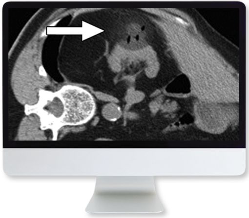 Cross-Sectional Renal Imaging: Techniques and Diagnosis 2020 (CME VIDEOS)