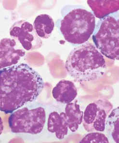 Hematopathology 2021 (CME VIDEOS)