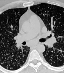 mrionline-imaging-mastery-series-micronodules-2021