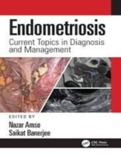 Endometriosis Current Topics in Diagnosis and Management 2022 Original PDF