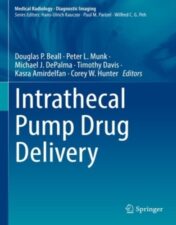 Intrathecal Pump Drug Delivery 2022 Original pdf