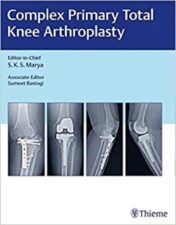 Complex Primary Total Knee Arthroplasty (Original PDF