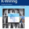 Overwhelming response to the first edition and compelling needs of the practicing orthopedic surgeon and the plastic, hand, and microvascular surgeon have seeded the way for the second edition of K-Wiring: Principles and Techniques