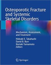 This edited book describes what fragile bone is, how the condition is assessed, and how it can be treated. It is intended for multi-professional trainees and practitioners in health and social care fields who care for and treat the elderly.