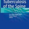 Tuberculosis of the Spine 2022 Original PDF