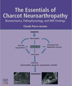 The Essentials of Charcot Neuroarthropathy: Biomechanics, Pathophysiology, and MRI Findings (Original PDF from Publisher)