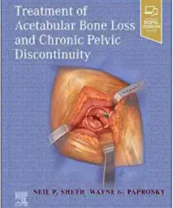 Treatment of Acetabular Bone Loss and Chronic Pelvic Discontinuity