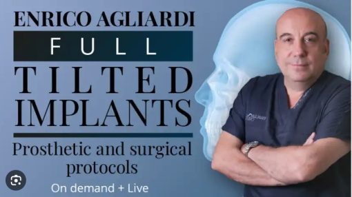 Full tilted implants Prosthetic and Surgical protocols