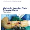 Minimally Invasive Plate Osteosynthesis