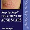 Step by Step Treatment of Acne Scars