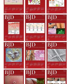 British Journal of Dermatology 2022 Full Archives