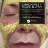 Chemical Peels in Clinical Practice