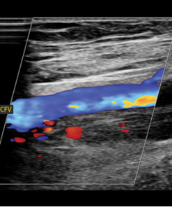 Clinical Approach to Vascular Ultrasound and RPVI Prep Course 2023