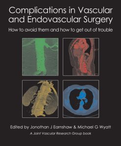 Complications in Vascular and Endovascular Surgery: How to avoid them and how to get out of trouble ()