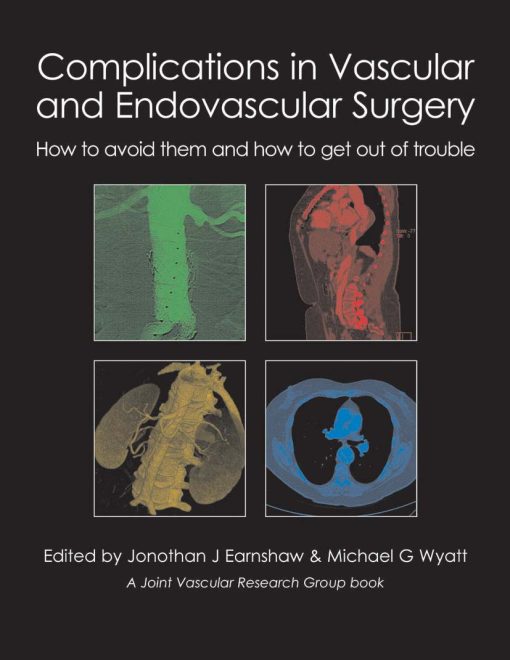 Complications in Vascular and Endovascular Surgery: How to avoid them and how to get out of trouble ()