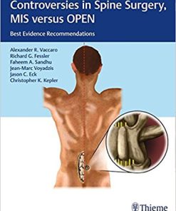 Controversies in Spine Surgery, MIS versus OPEN: Best Evidence Recommendations ()