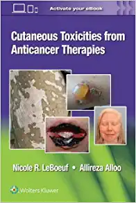 Cutaneous Reactions from Anti-Cancer Therapies ()